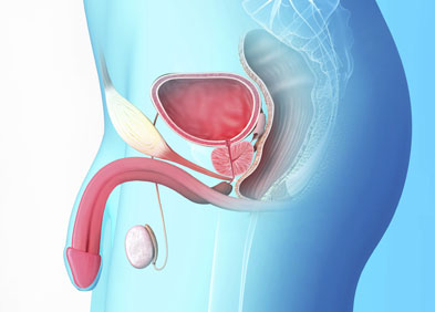 Cancer la prostate symptome. Most cancers Colon Tratament